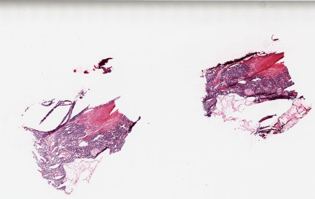 Slide Thumbnail