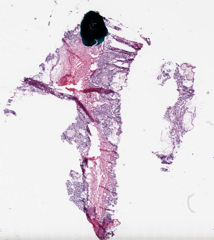 Slide Thumbnail