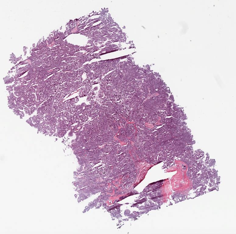 Slide Thumbnail