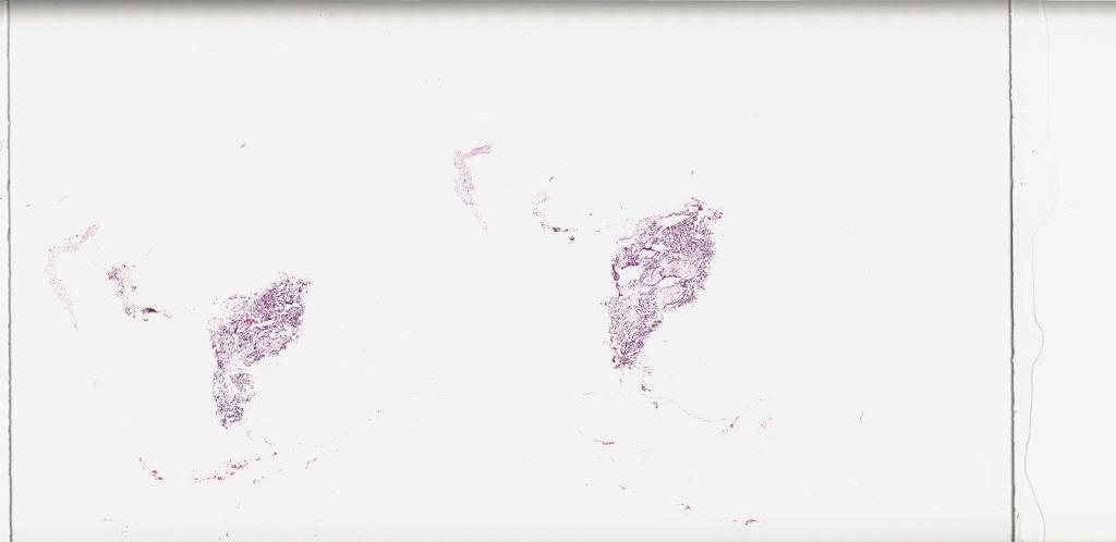 Slide Thumbnail