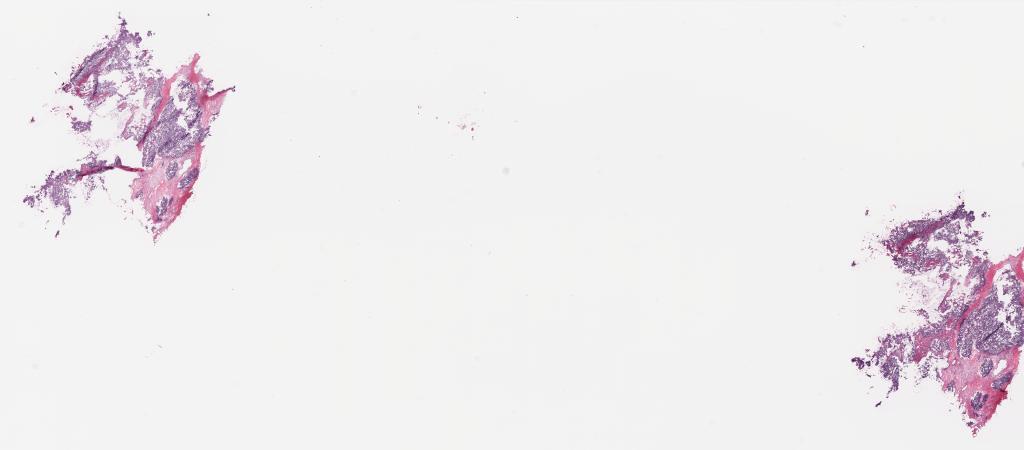 Slide Thumbnail