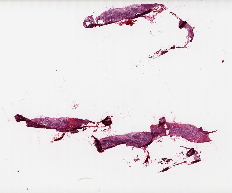 Slide Thumbnail