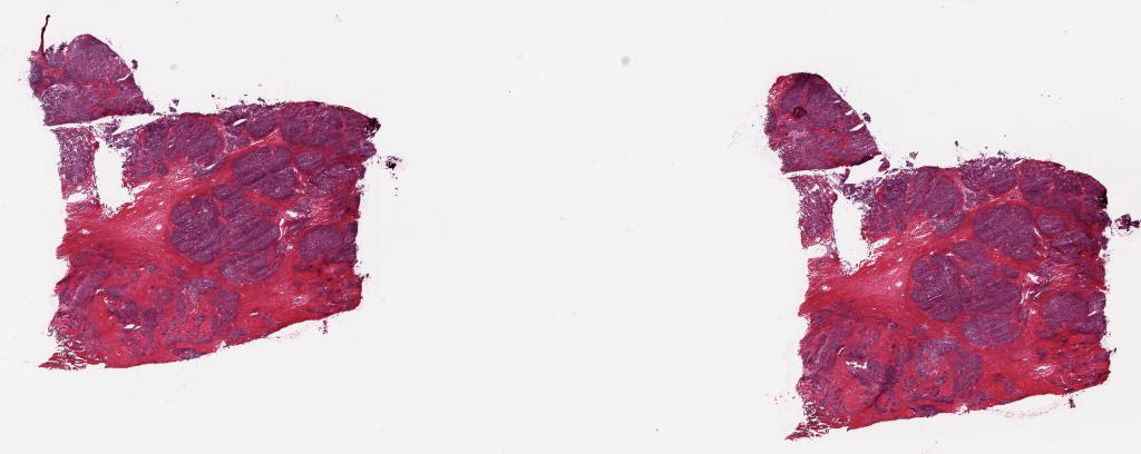 Slide Thumbnail