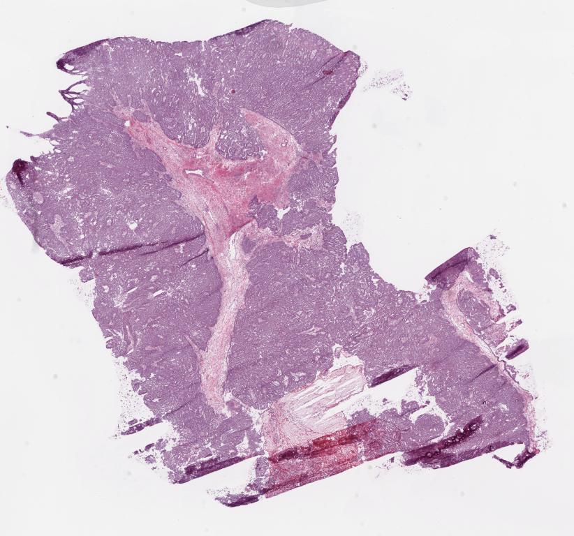 Slide Thumbnail