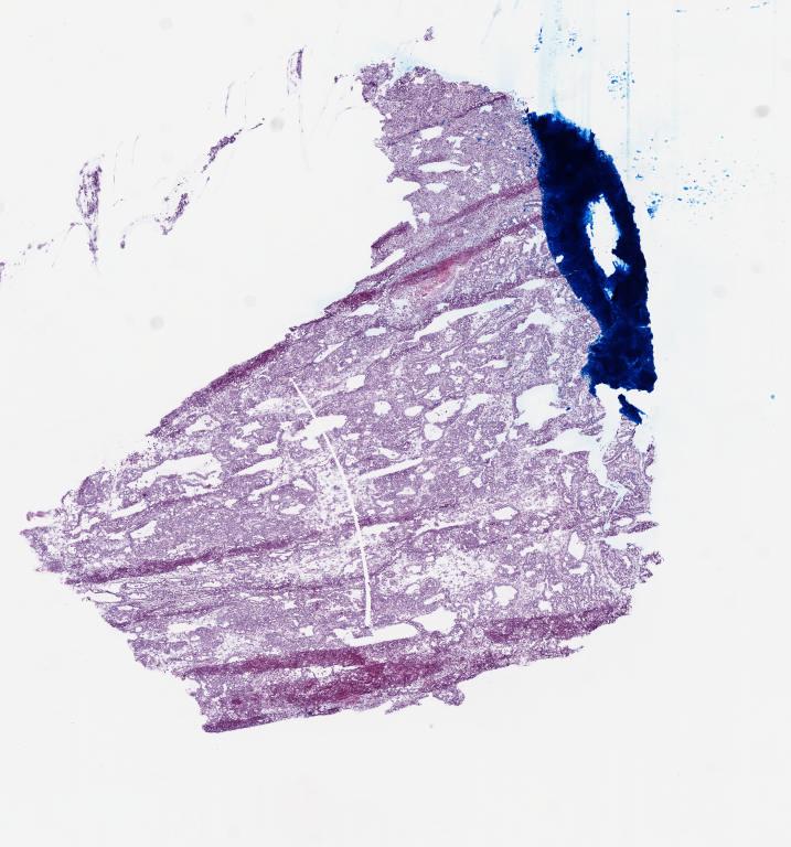 Slide Thumbnail