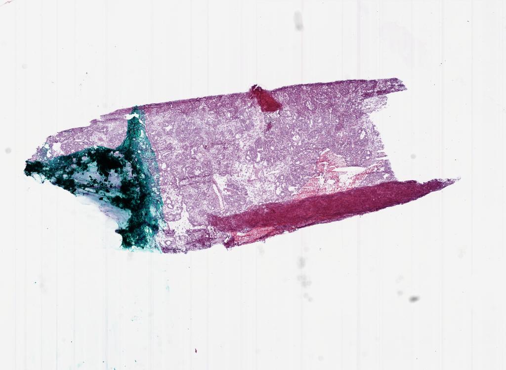 Slide Thumbnail