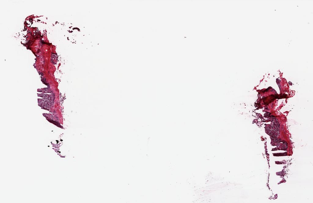 Slide Thumbnail