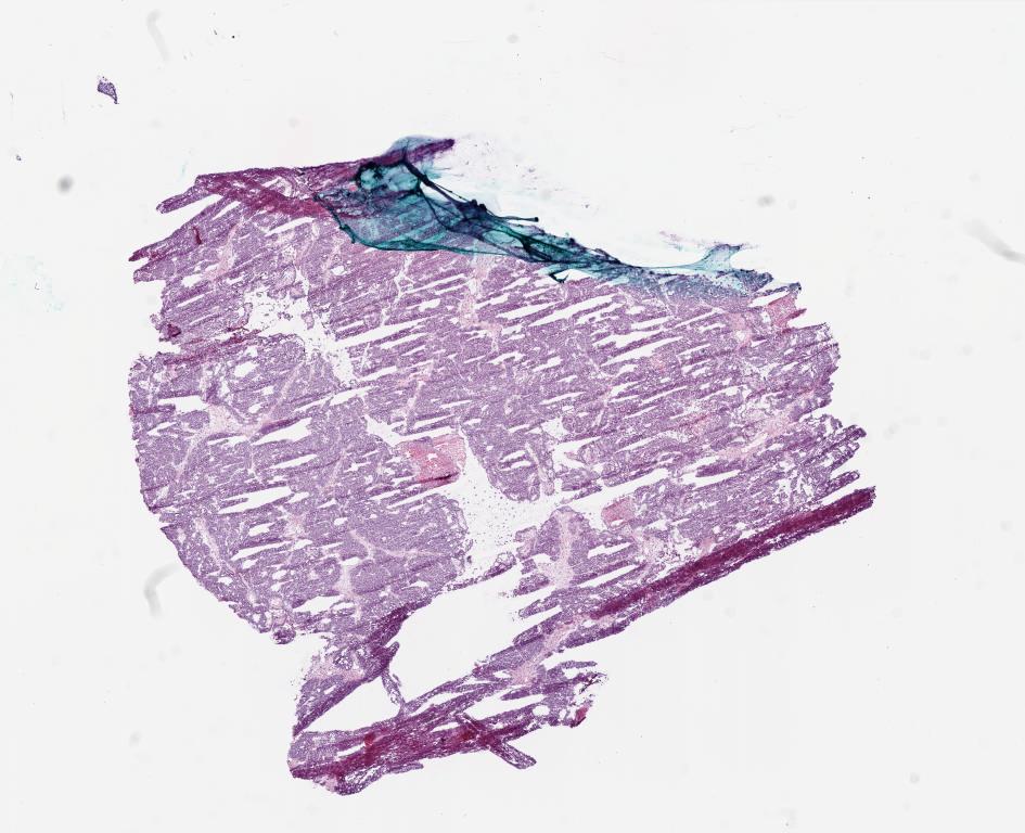 Slide Thumbnail