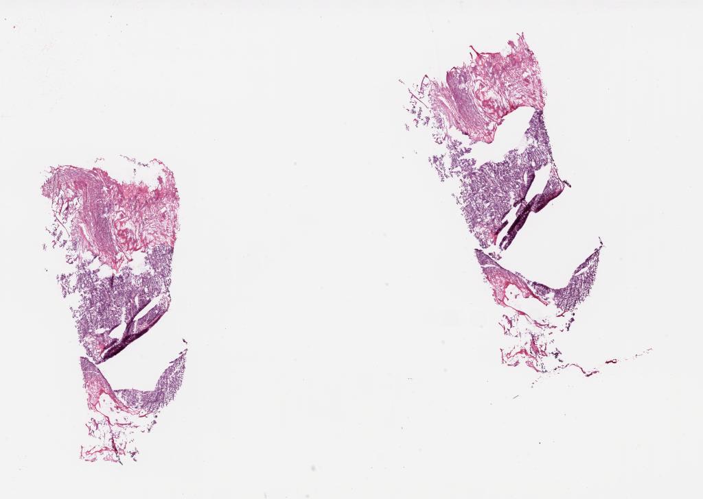 Slide Thumbnail