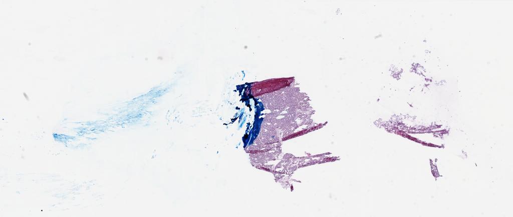 Slide Thumbnail