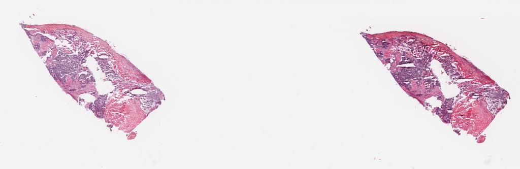 Slide Thumbnail