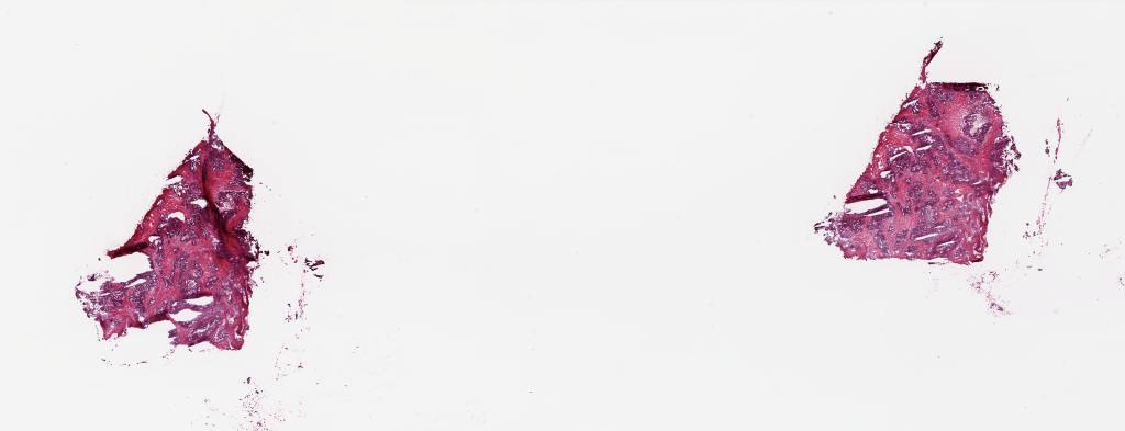 Slide Thumbnail