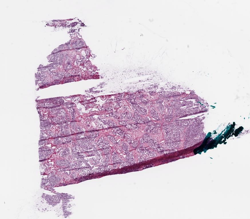 Slide Thumbnail