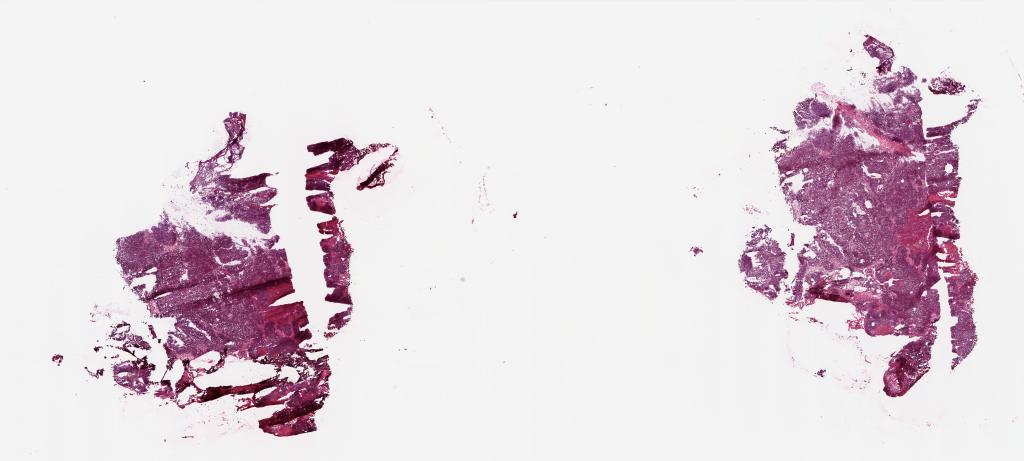 Slide Thumbnail