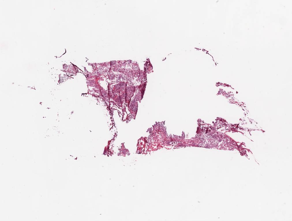 Slide Thumbnail