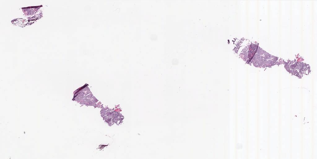 Slide Thumbnail