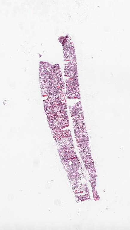 Slide Thumbnail