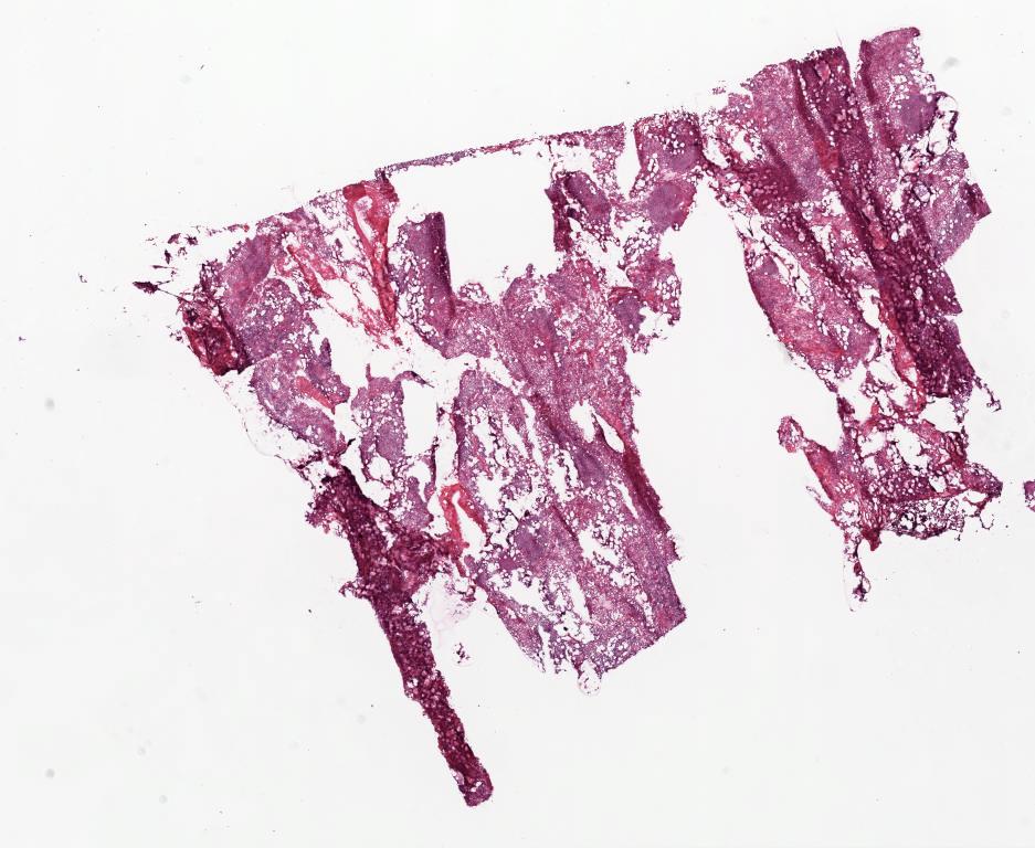 Slide Thumbnail