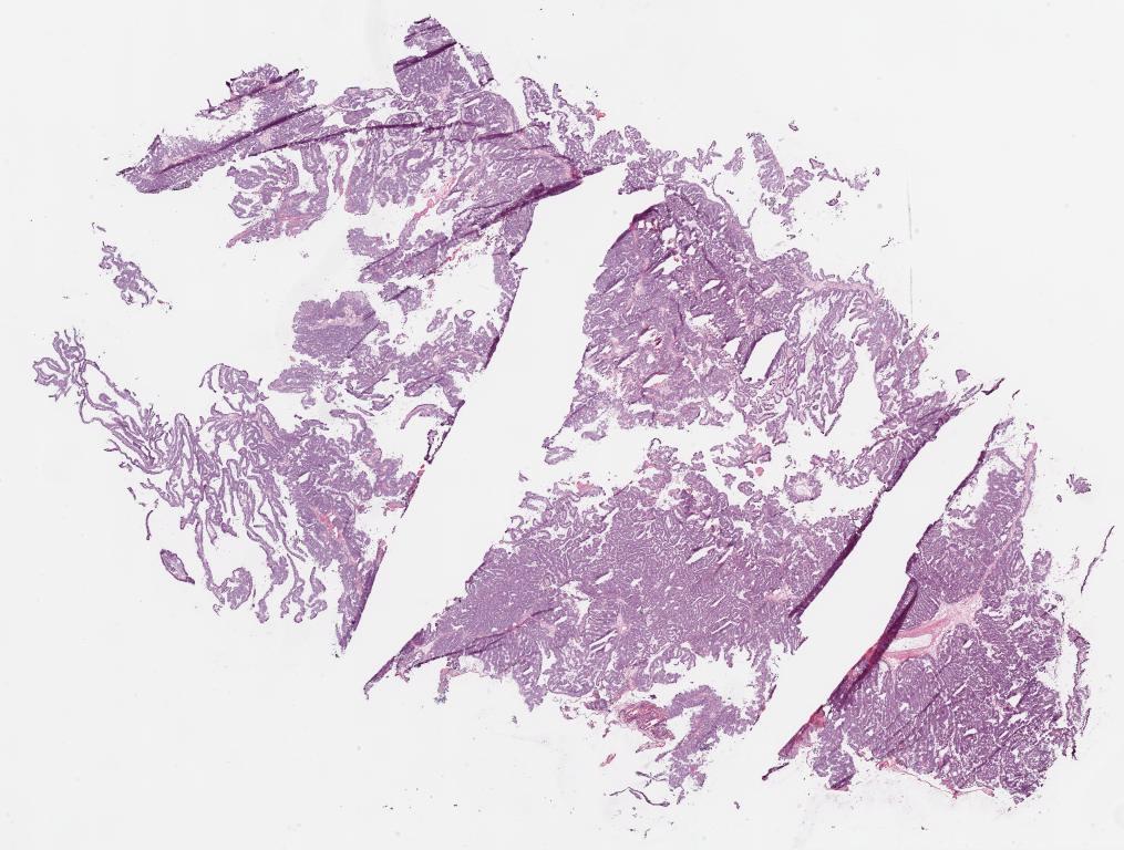 Slide Thumbnail