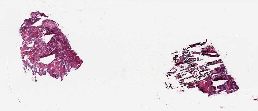 Slide Thumbnail