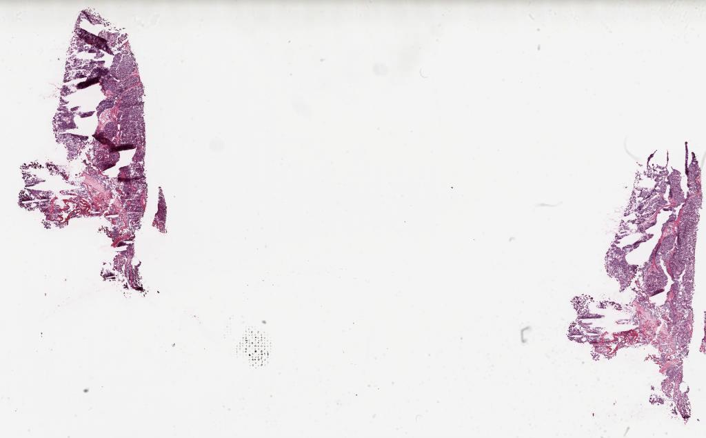 Slide Thumbnail