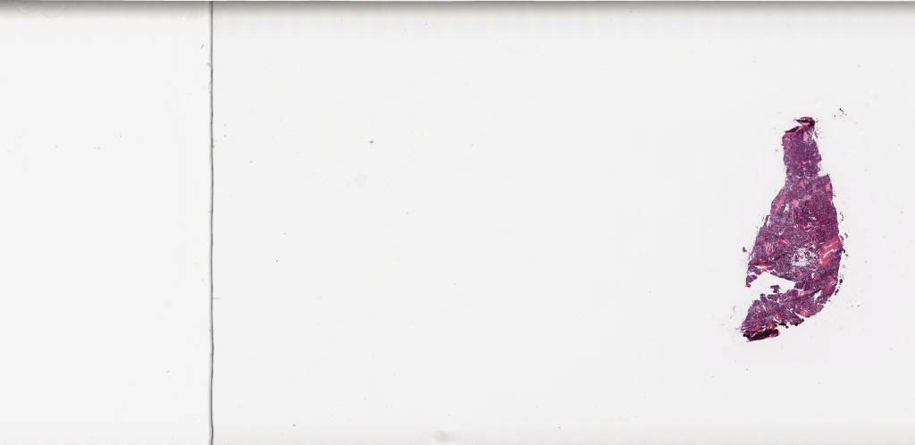 Slide Thumbnail