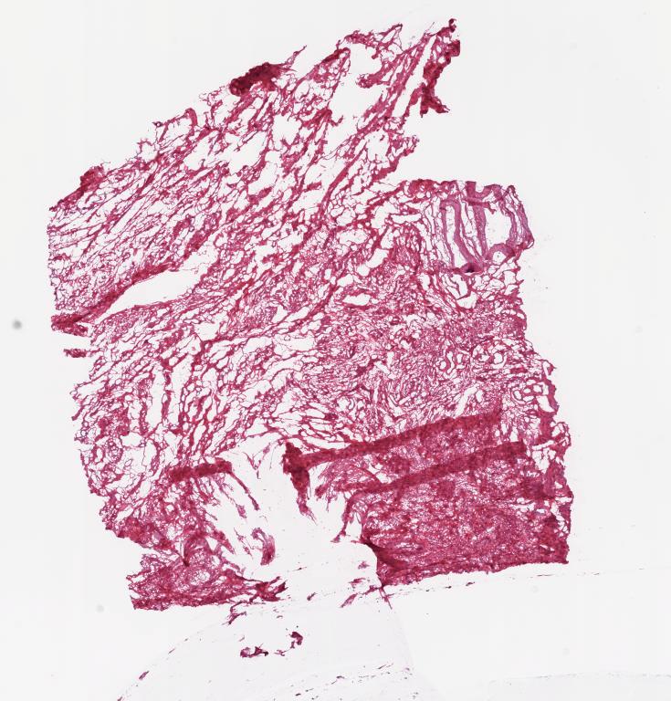 Slide Thumbnail