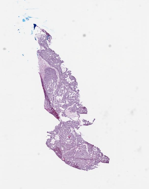 Slide Thumbnail