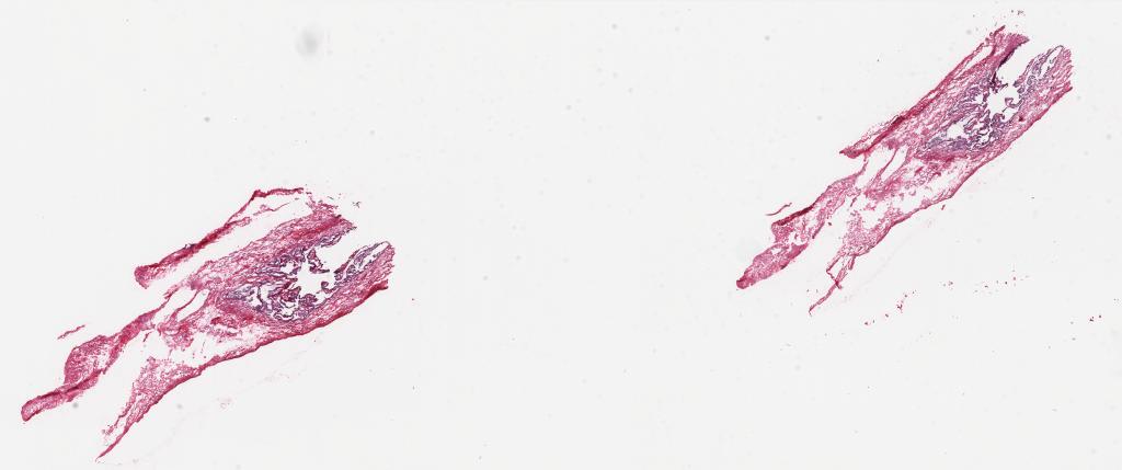 Slide Thumbnail