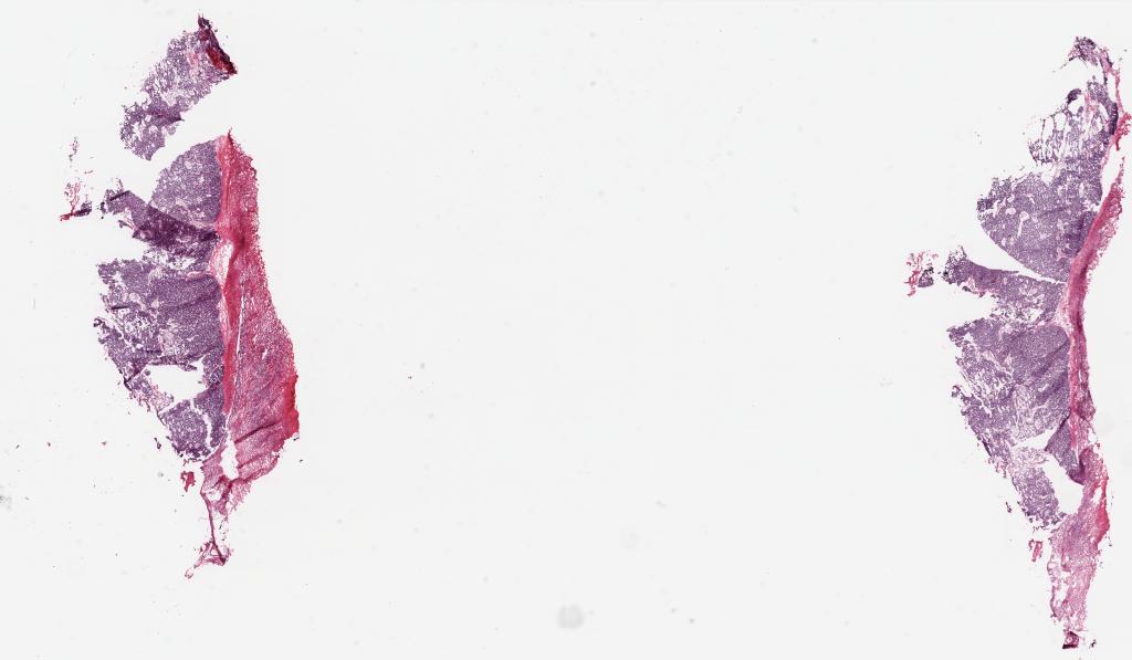 Slide Thumbnail