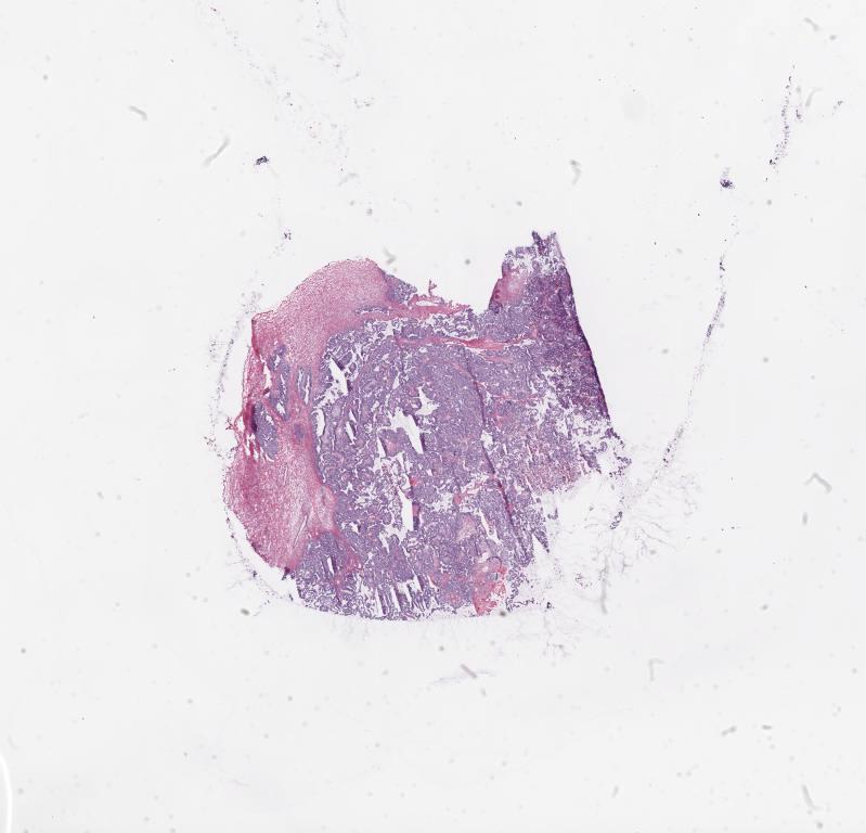 Slide Thumbnail