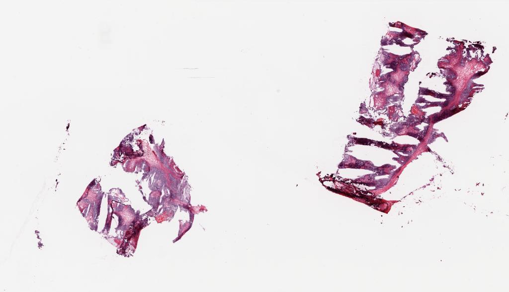 Slide Thumbnail
