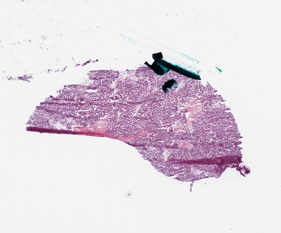 Slide Thumbnail