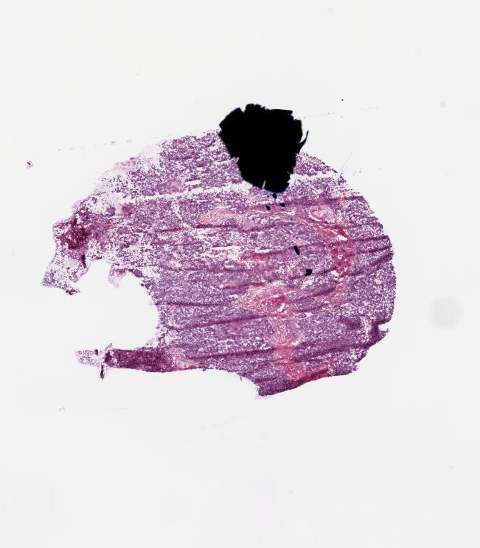 Slide Thumbnail