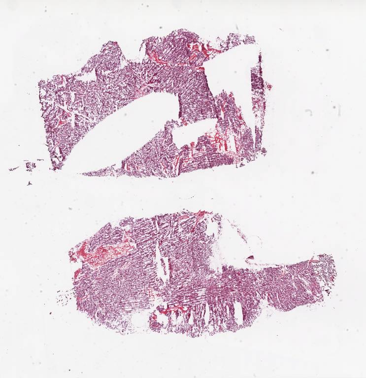 Slide Thumbnail