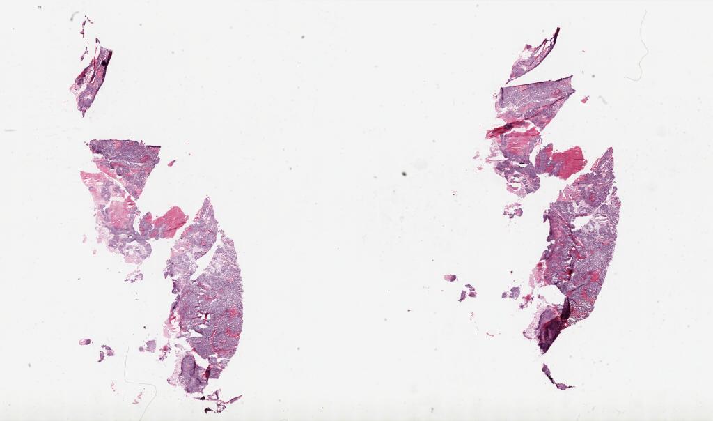 Slide Thumbnail