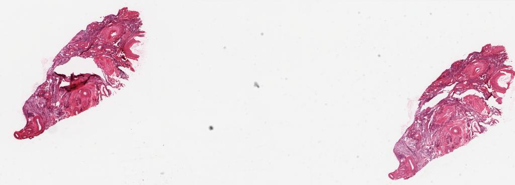 Slide Thumbnail