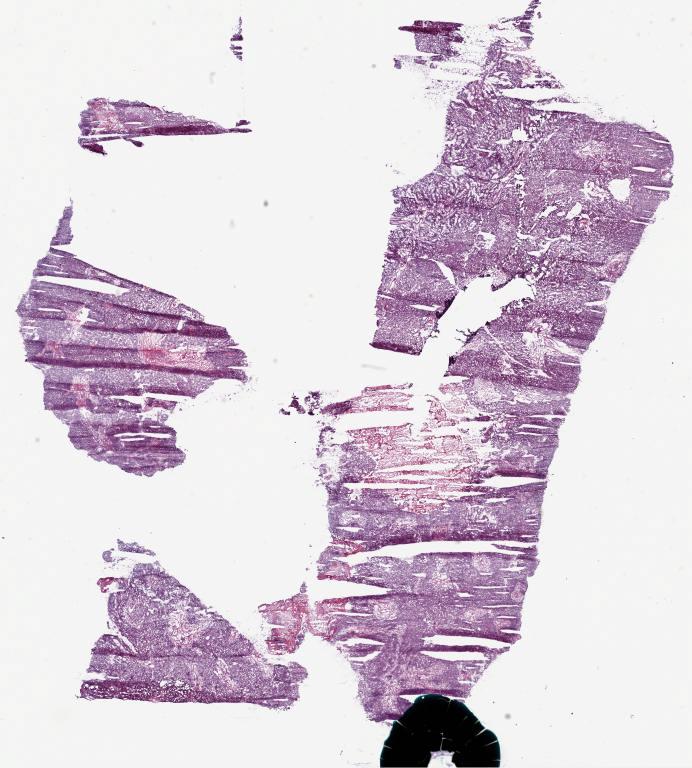Slide Thumbnail