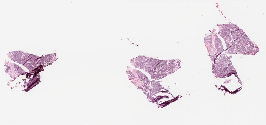Slide Thumbnail