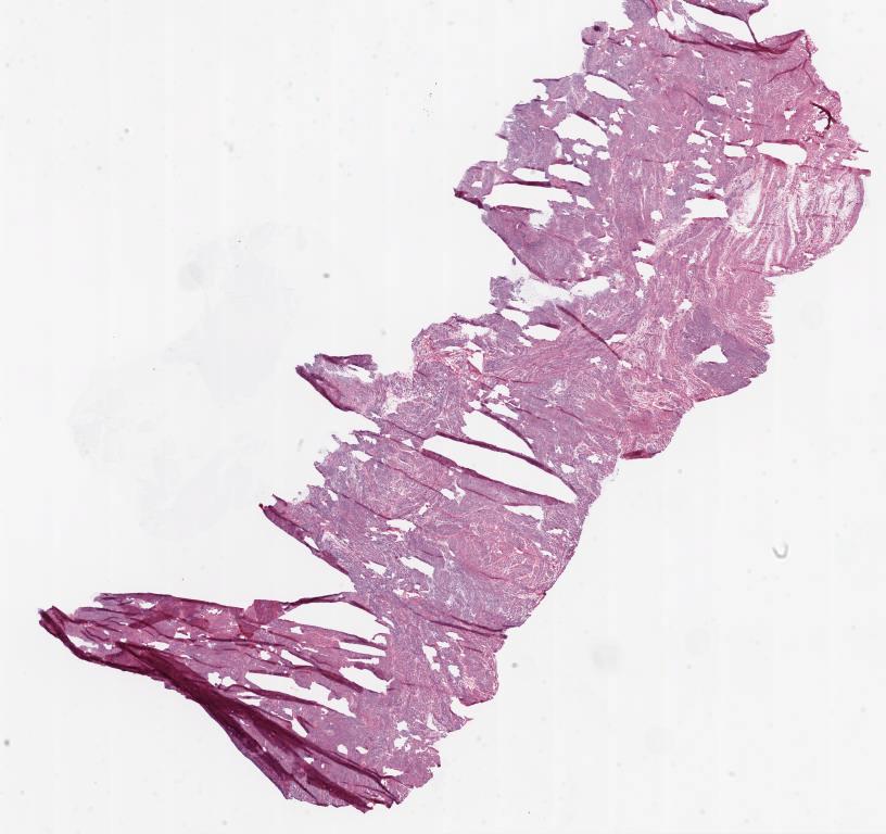 Slide Thumbnail