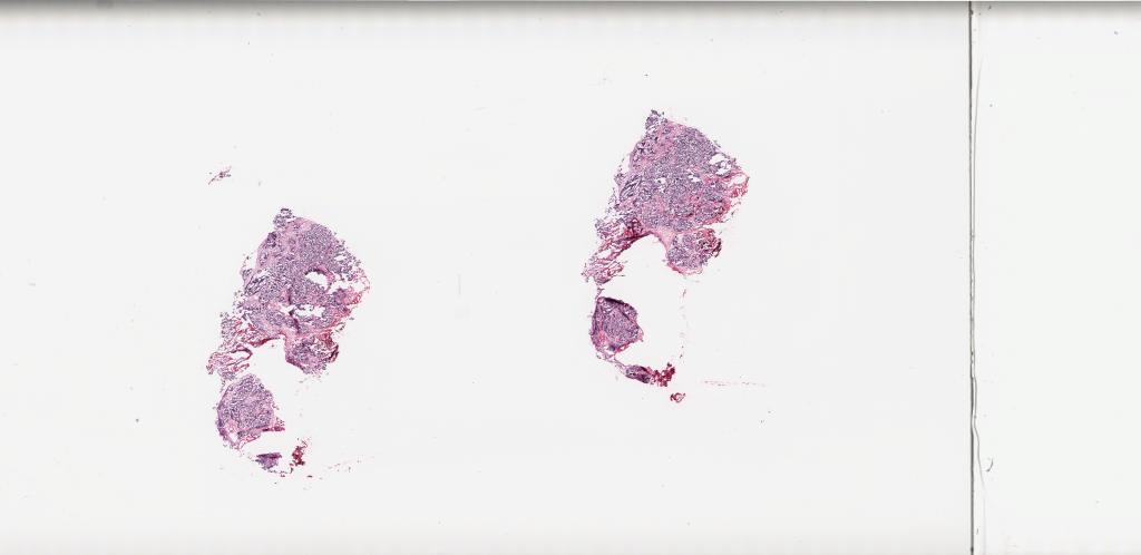 Slide Thumbnail