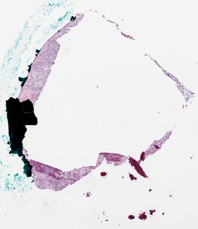 Slide Thumbnail
