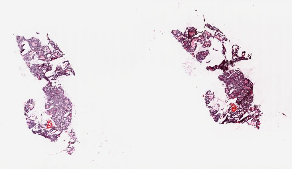 Slide Thumbnail