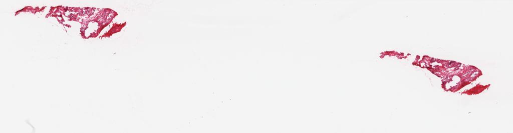 Slide Thumbnail