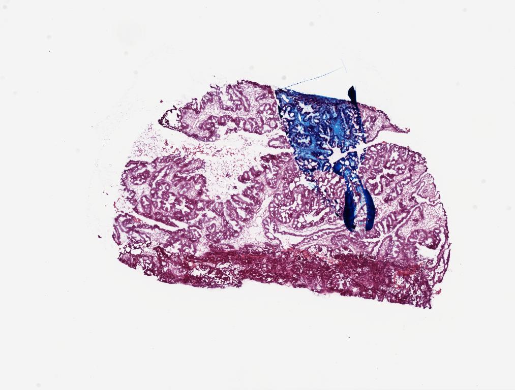 Slide Thumbnail