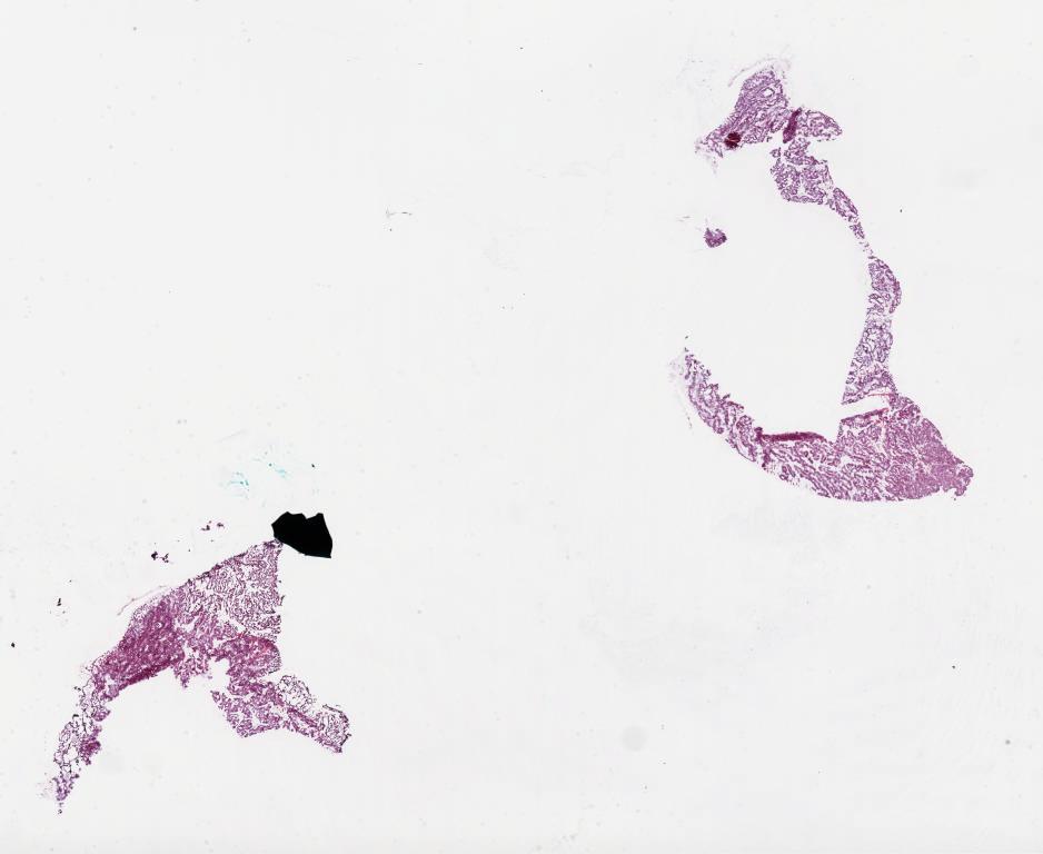 Slide Thumbnail