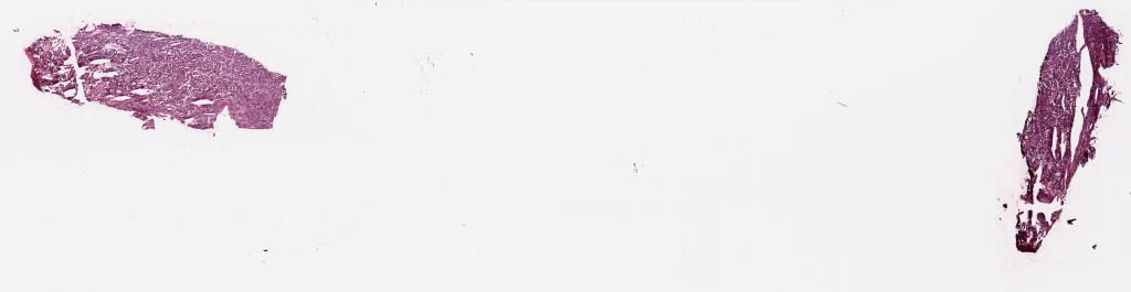 Slide Thumbnail