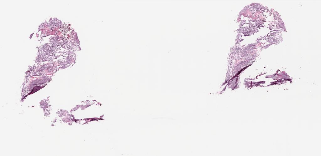 Slide Thumbnail