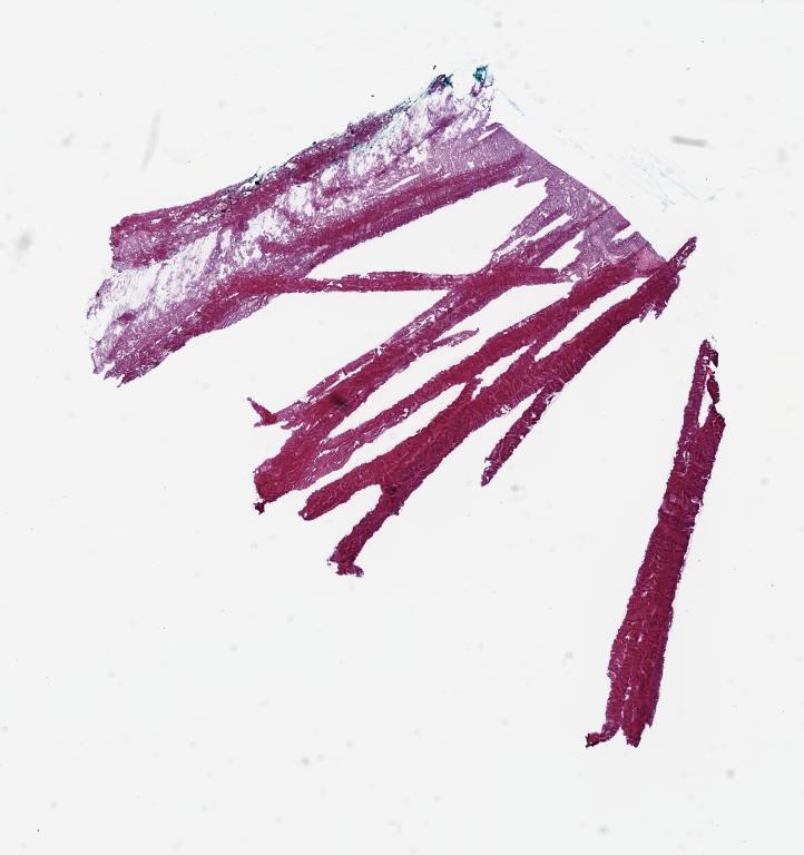 Slide Thumbnail
