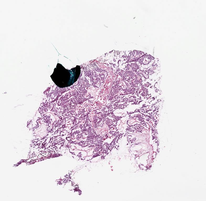 Slide Thumbnail